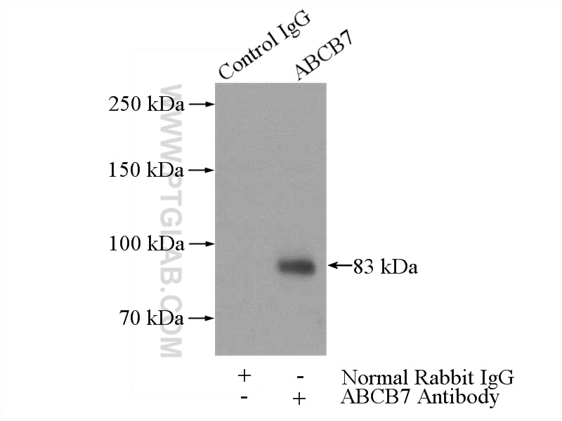 IP experiment of mouse liver using 11158-1-AP