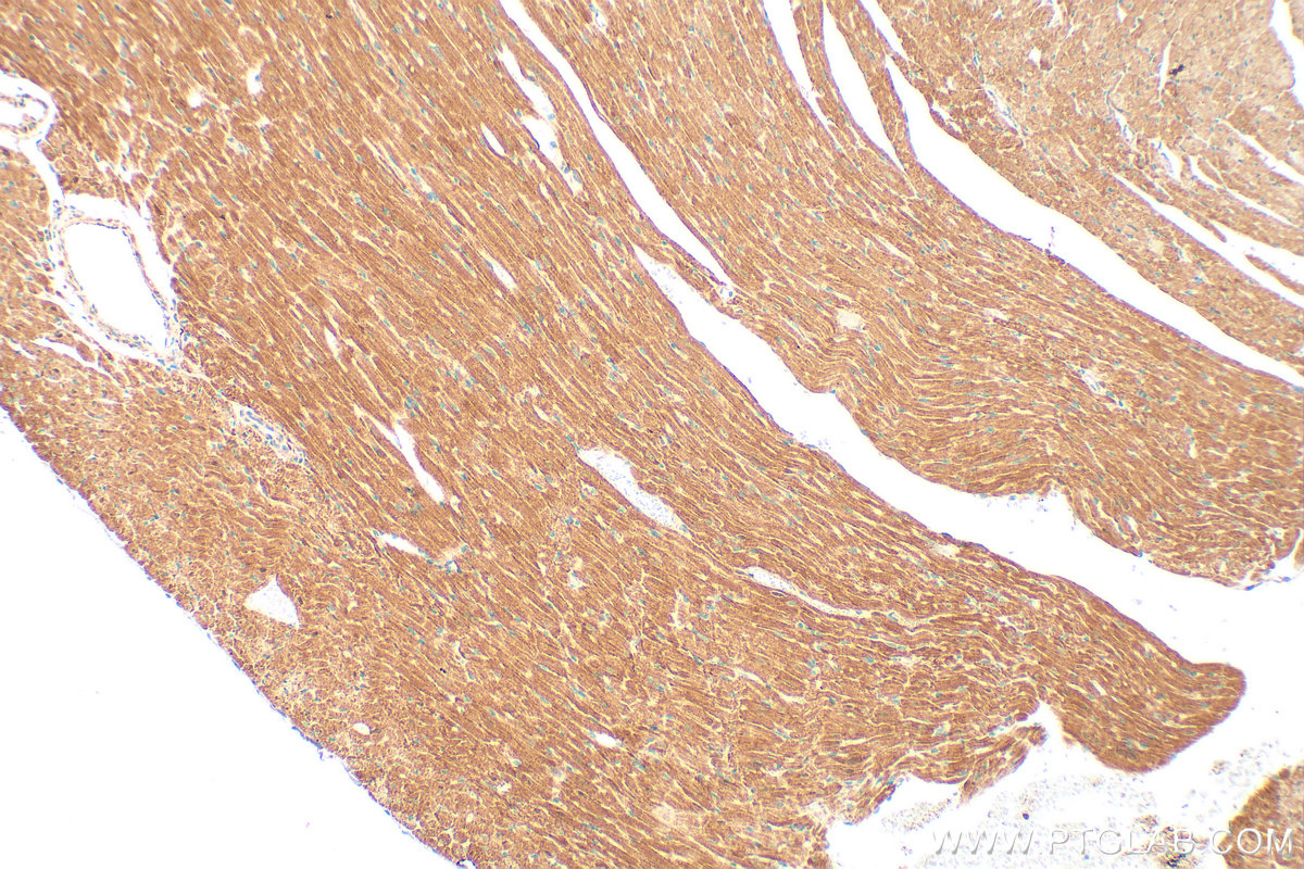 IHC staining of mouse heart using 25867-1-AP IHC staining of mouse heart using 25867-1-AP