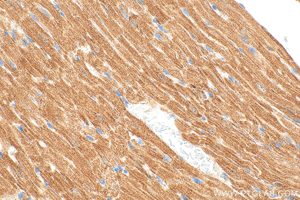 IHC staining of mouse heart using 25867-1-AP IHC staining of mouse heart using 25867-1-AP