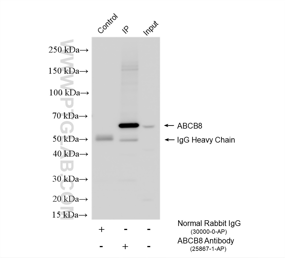 IP experiment of rat heart using 25867-1-AP IP experiment of rat heart using 25867-1-AP