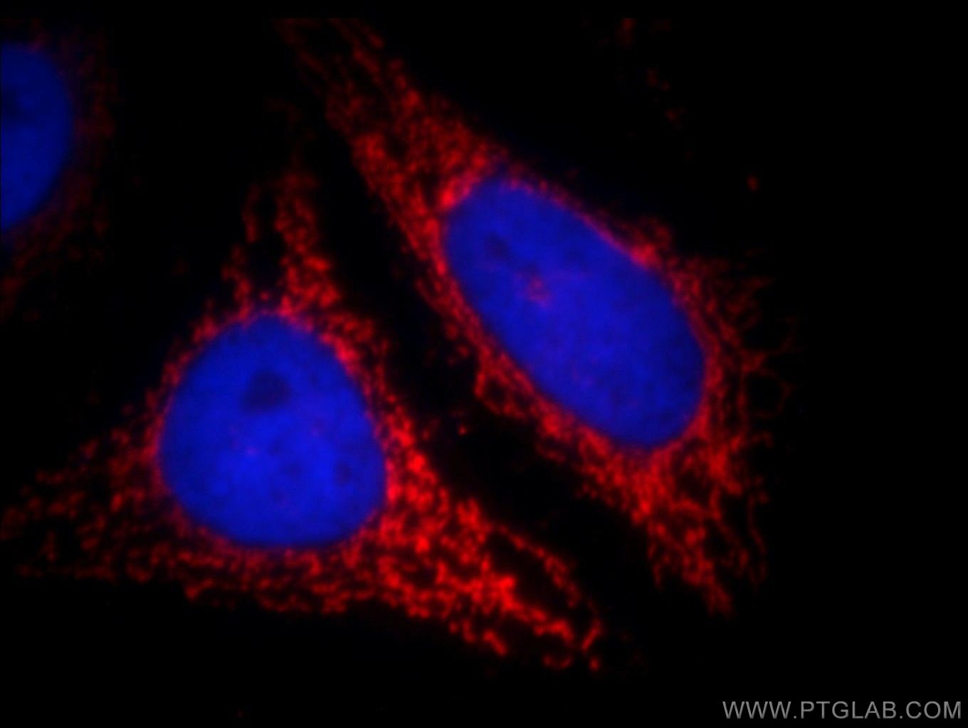 IF Staining of HepG2 using 11066-1-AP