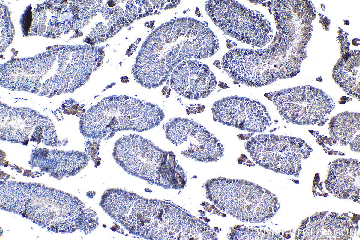 IHC staining of mouse testis using 11066-1-AP