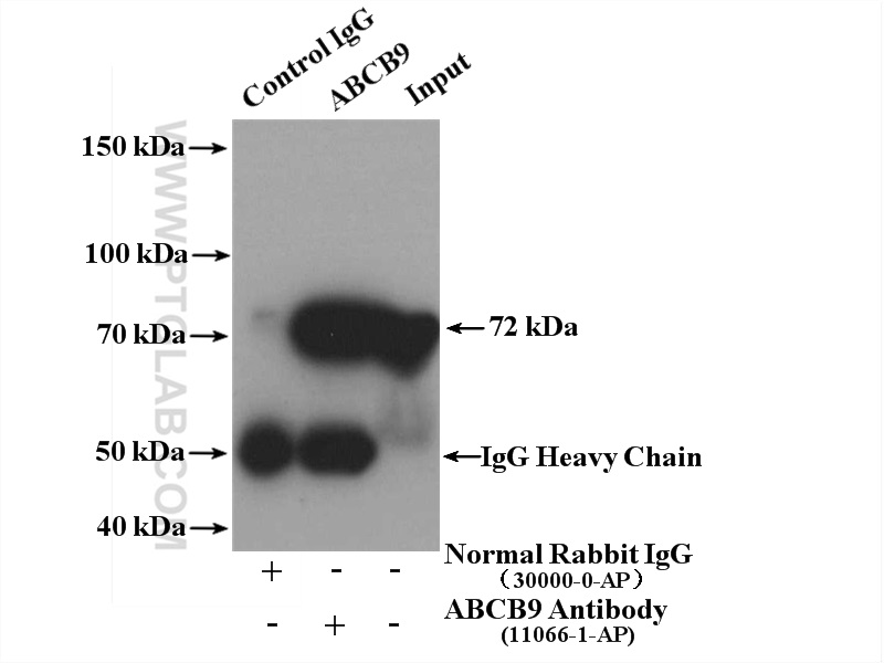 IP experiment of mouse thymus using 11066-1-AP