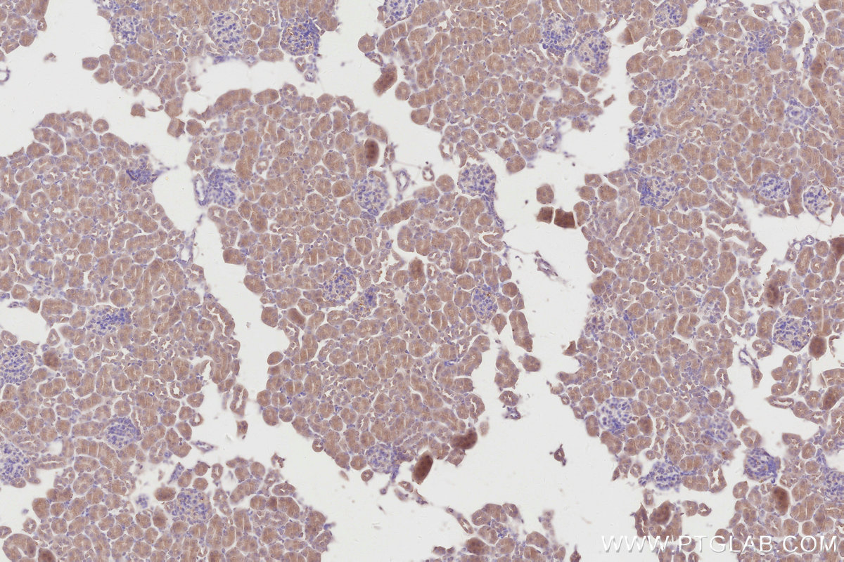 IHC staining of mouse kidney using 67228-1-Ig IHC staining of mouse kidney using 67228-1-Ig