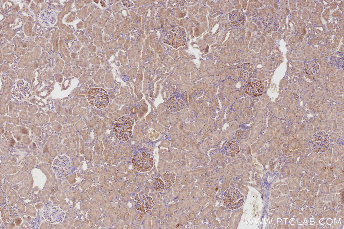 IHC staining of rat kidney using 67228-1-Ig IHC staining of rat kidney using 67228-1-Ig
