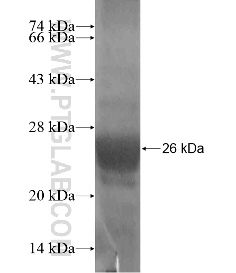 ABCC12 fusion protein Ag19270 SDS-PAGE ABCC12 fusion protein Ag19270 SDS-PAGE