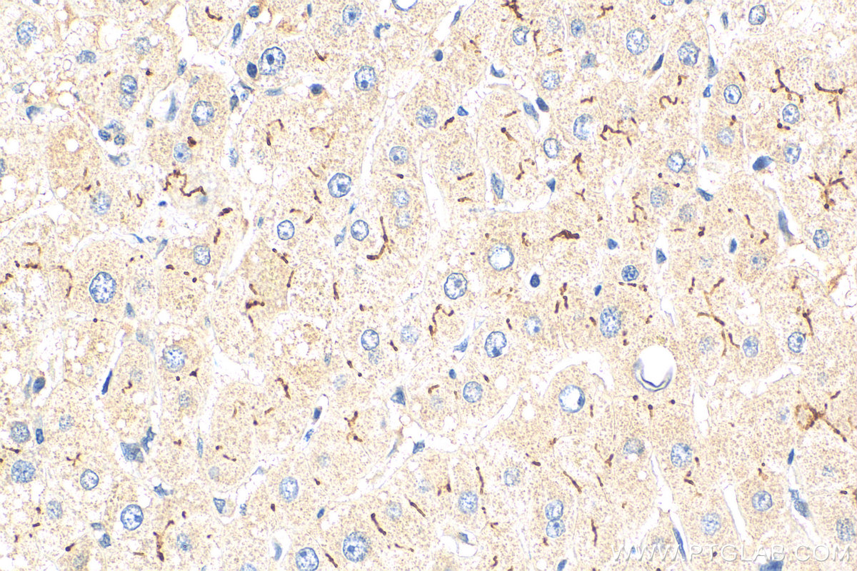 IHC staining of human liver using 29261-1-AP