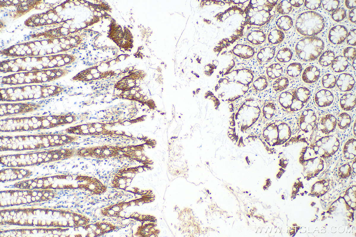 IHC staining of human colon using 25358-1-AP