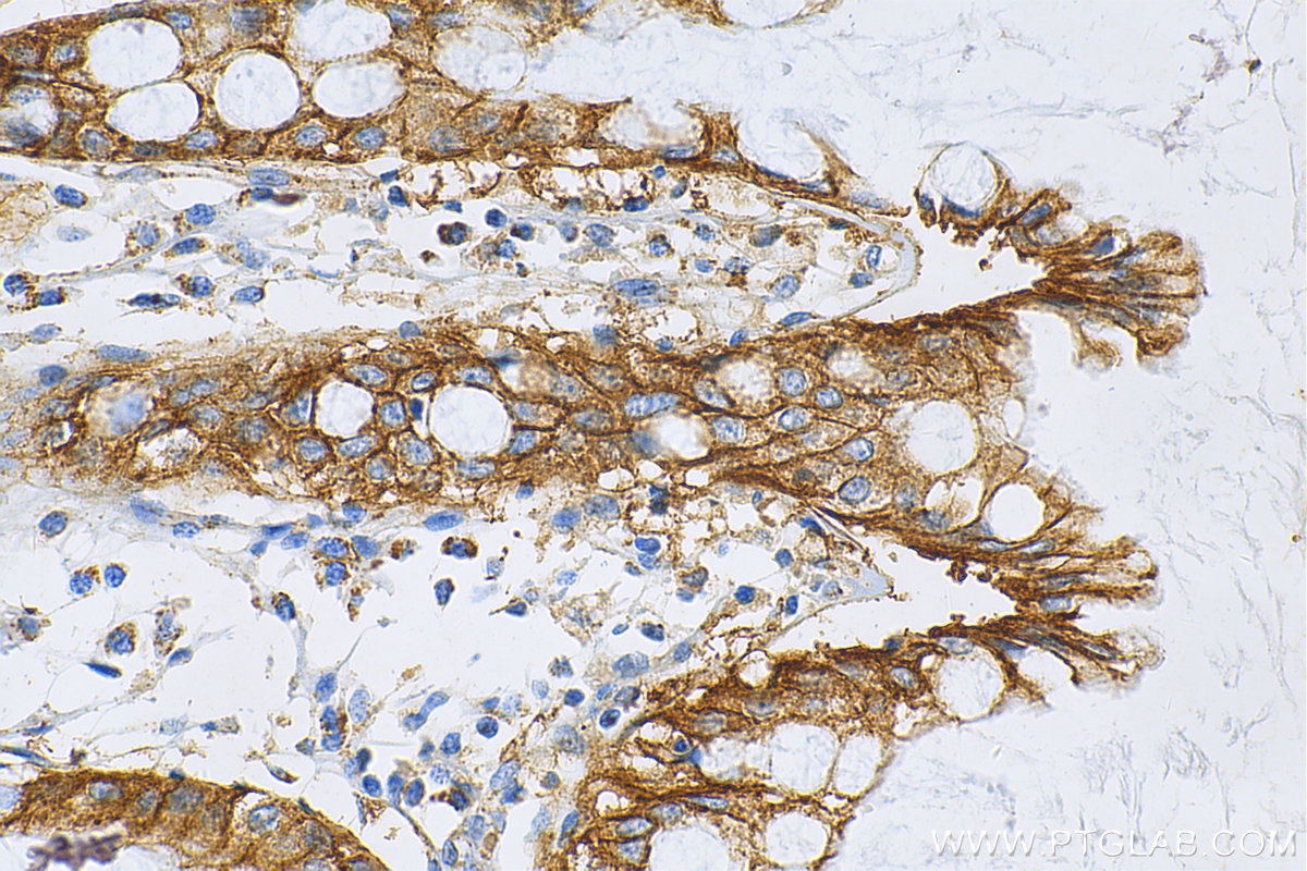 IHC staining of human colon using 25358-1-AP