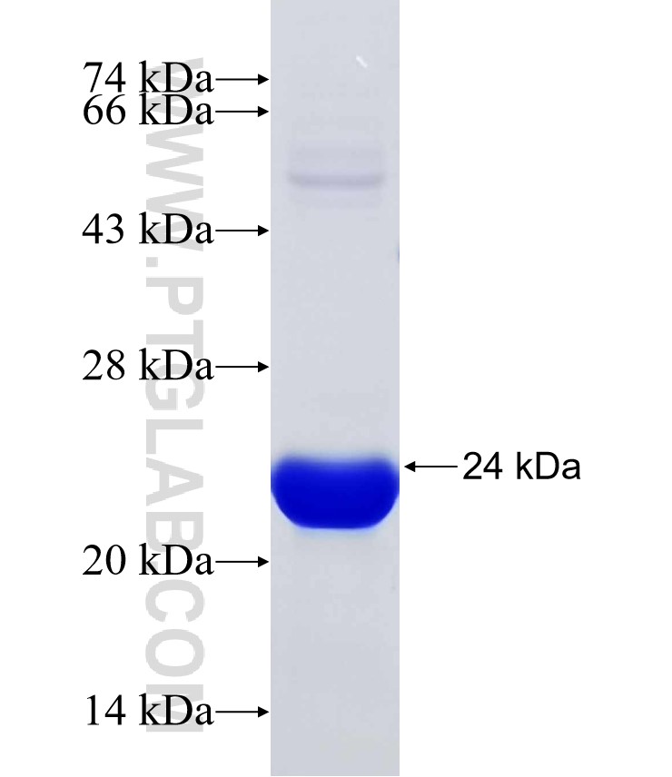 ABCC5 fusion protein Ag31674 SDS-PAGE