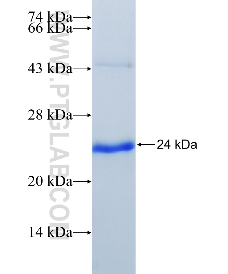 ABCC5 fusion protein Ag31674 SDS-PAGE