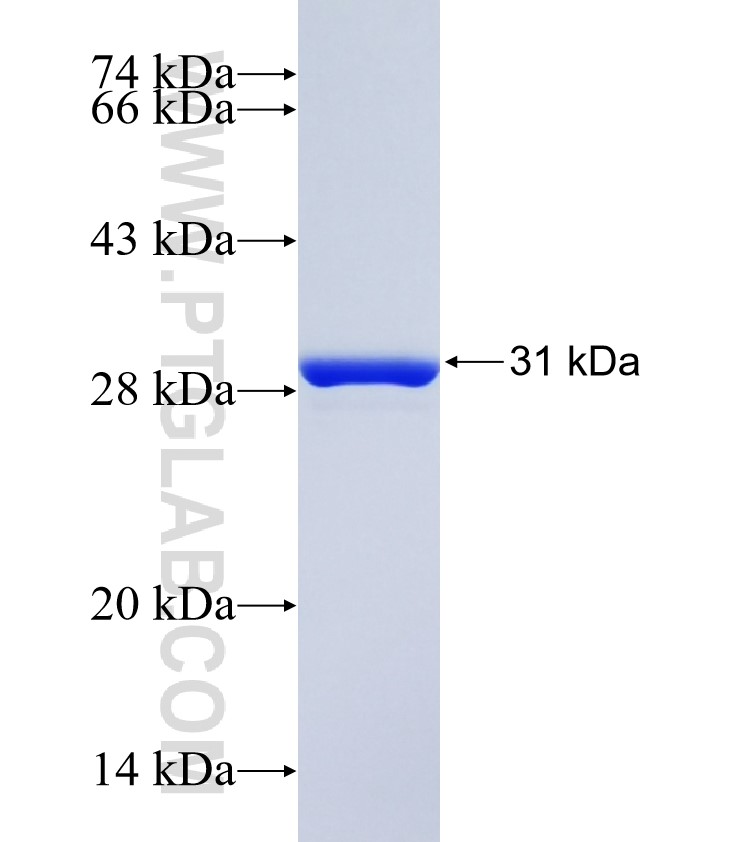 ABCC9 fusion protein Ag34501 SDS-PAGE ABCC9 fusion protein Ag34501 SDS-PAGE