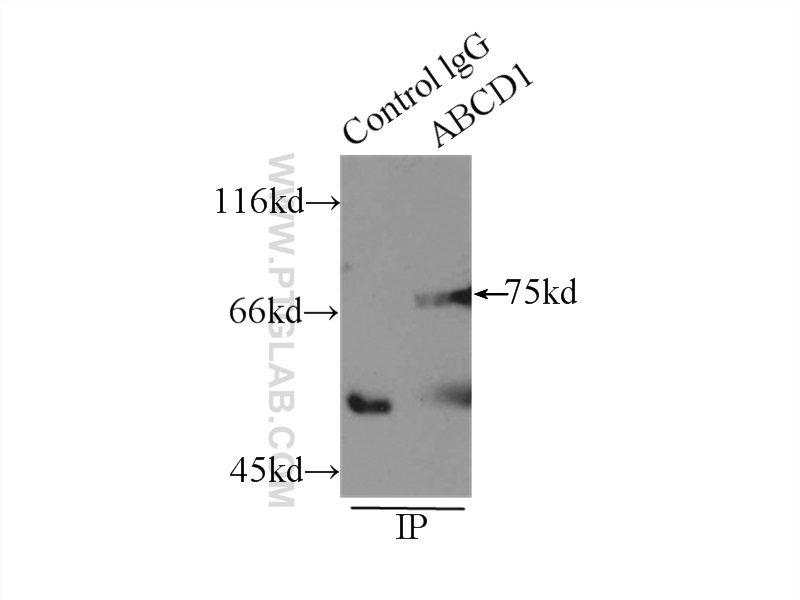 IP experiment of mouse liver using 11159-1-AP