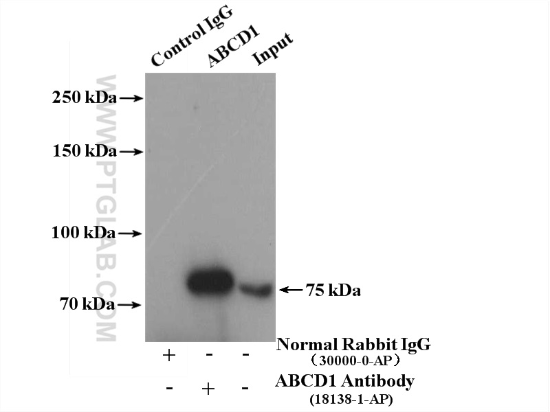 IP experiment of HeLa using 18138-1-AP