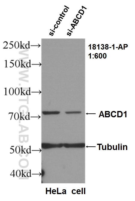 WB analysis of HeLa using 18138-1-AP