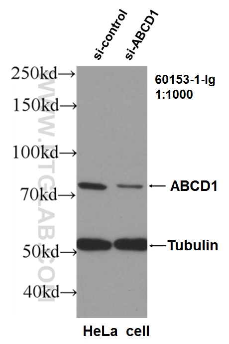 WB analysis of HeLa using 60153-1-Ig