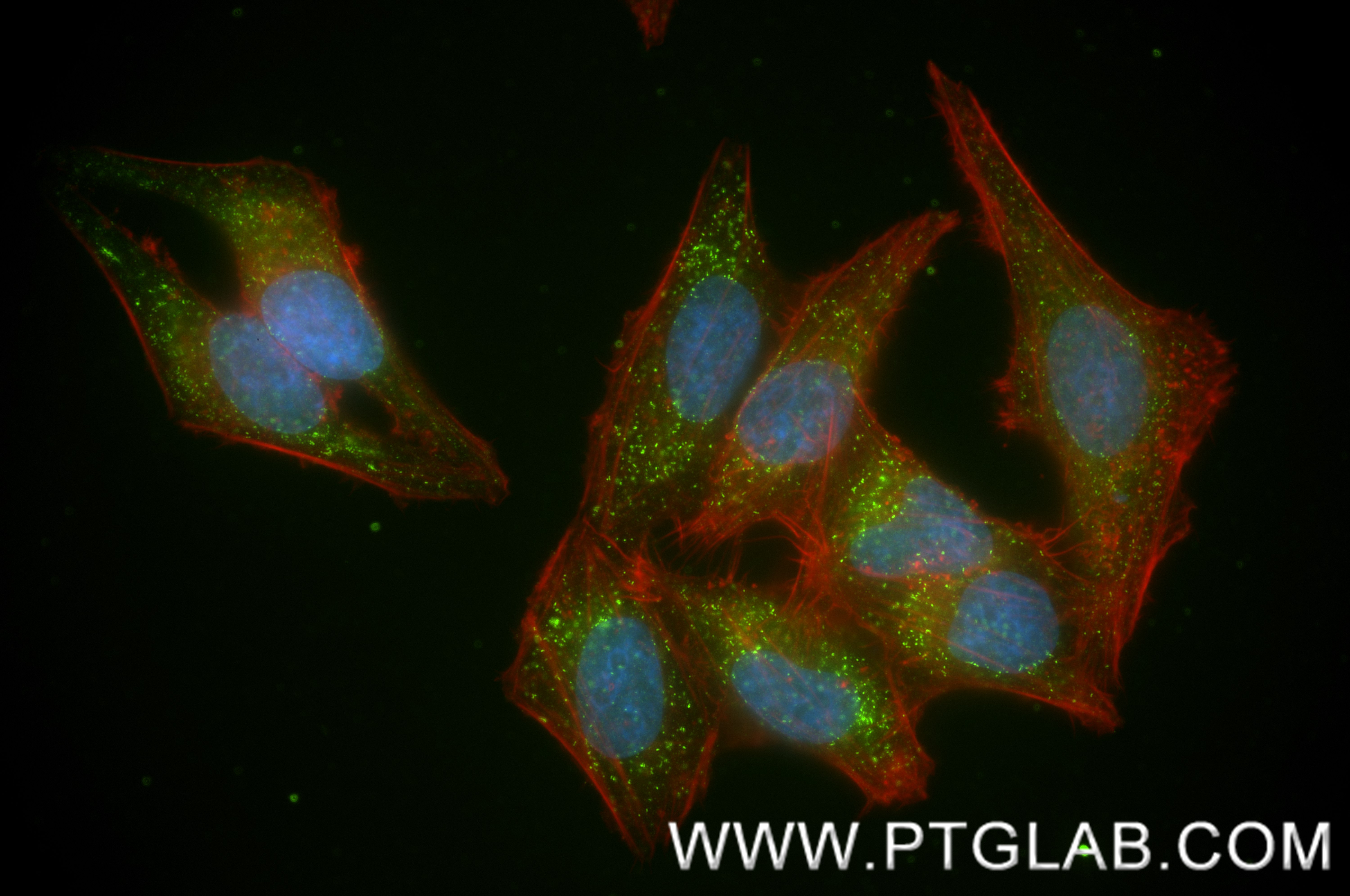 Immunofluorescent analysis of (4% PFA) fixed HepG2 cells using ABCD1 antibody (<a class='green' href='/productredirect?CatalogNo=83038-4-RR' target='_blank'>83038-4-RR</a>, Clone: 230226E12 ) at dilution of 1:400 and CoraLite®488-Conjugated Goat Anti-Rabbit IgG(H+L) (<a class='green' href='/productredirect?CatalogNo=SA00013-2' target='_blank'>SA00013-2</a>), CL594-Phalloidin (red). This data was developed using the same antibody clone with 83038-4-PBS in a different storage buffer formulation. IF Staining of HepG2 using 83038-4-RR (same clone as 83038-4-PBS)