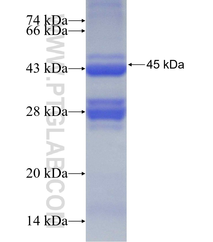 ABCD1 fusion protein Ag1635 SDS-PAGE