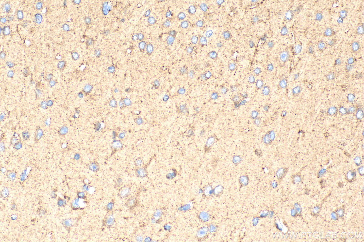 IHC staining of mouse brain using 18179-1-AP
