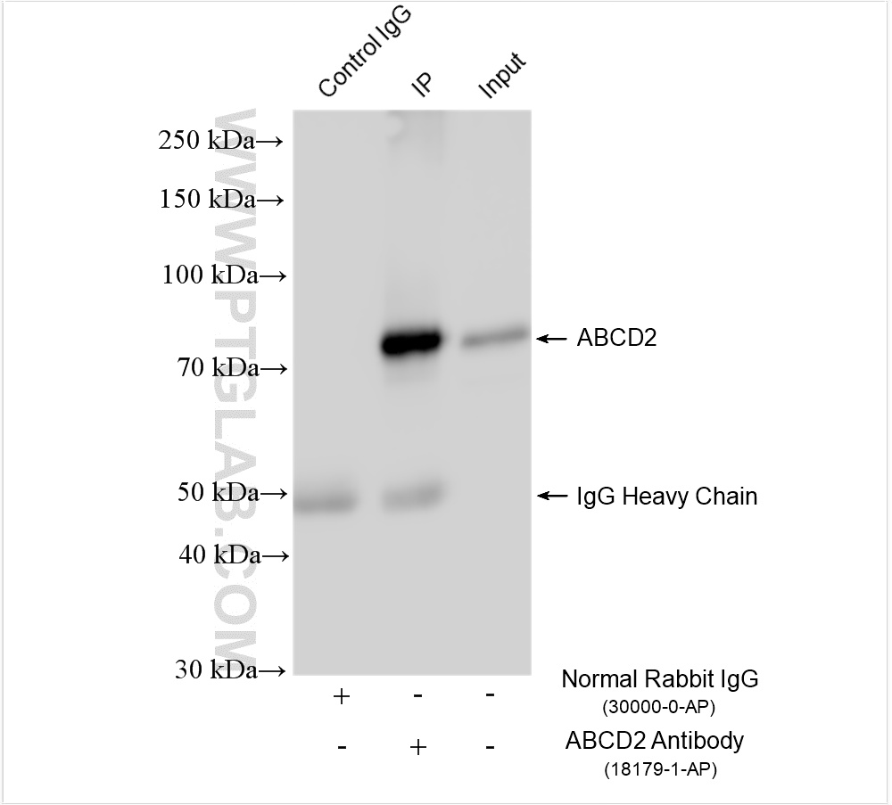 IP experiment of mouse adipose using 18179-1-AP