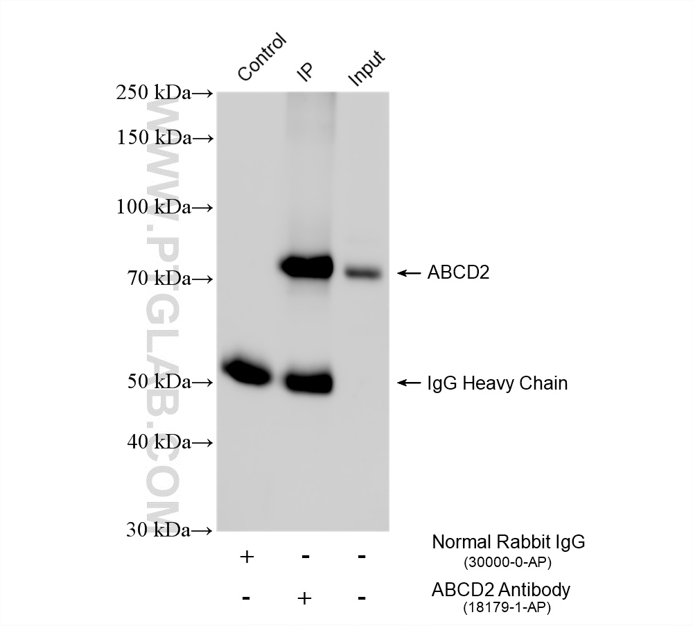 IP experiment of mouse adipose using 18179-1-AP