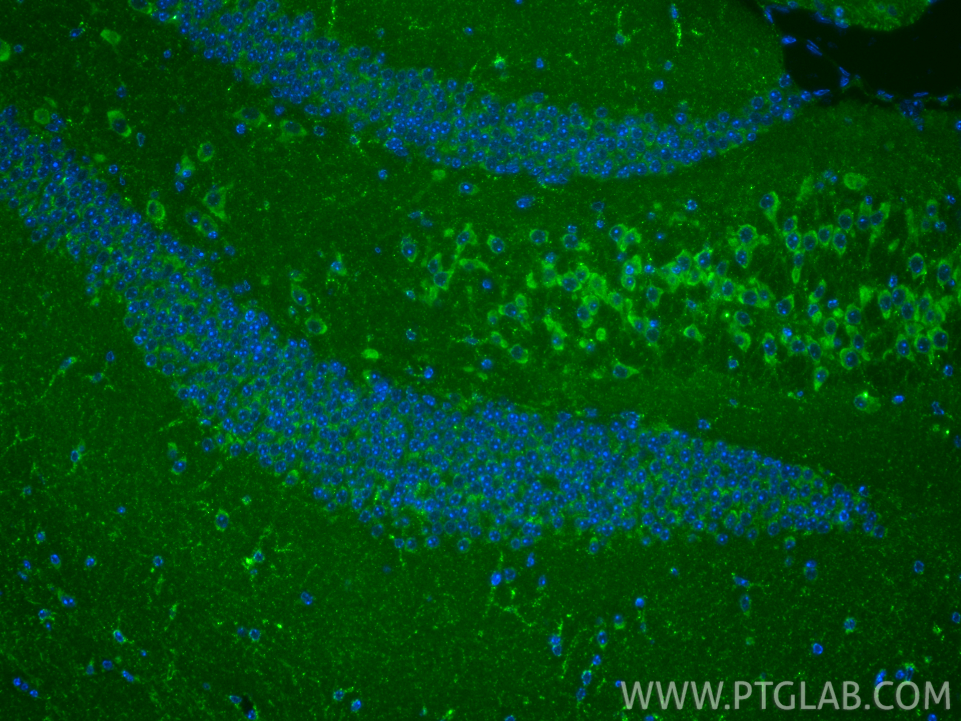 IF Staining of mouse brain using 86519-4-RR (same clone as 86519-4-PBS) IF Staining of mouse brain using 86519-4-RR (same clone as 86519-4-PBS)