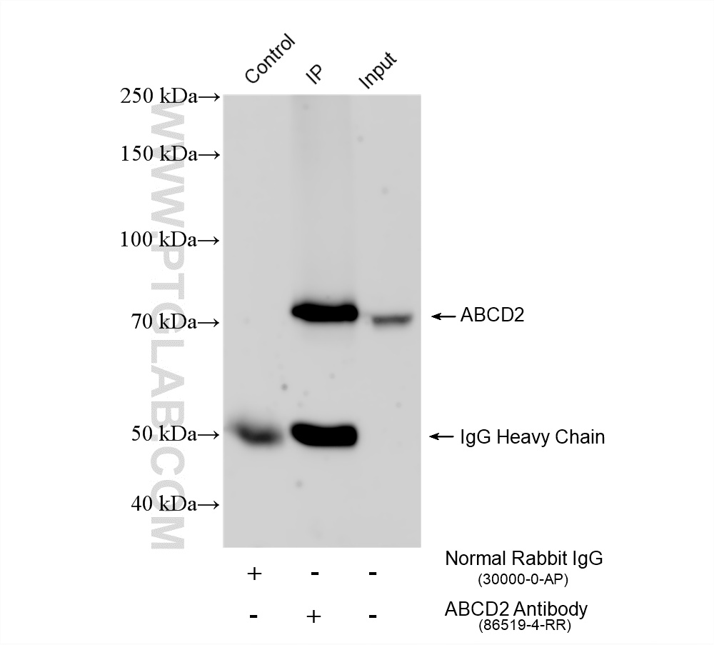 IP experiment of mouse cerebellum using 86519-4-RR