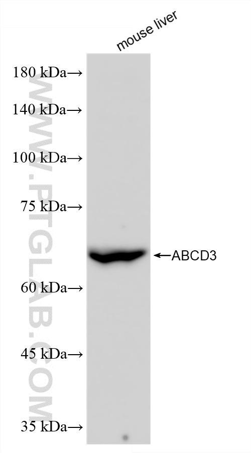 WB analysis of mouse liver using 87047-1-RR