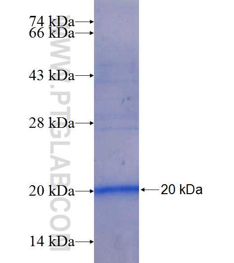 ABCD3 fusion protein Ag24760 SDS-PAGE