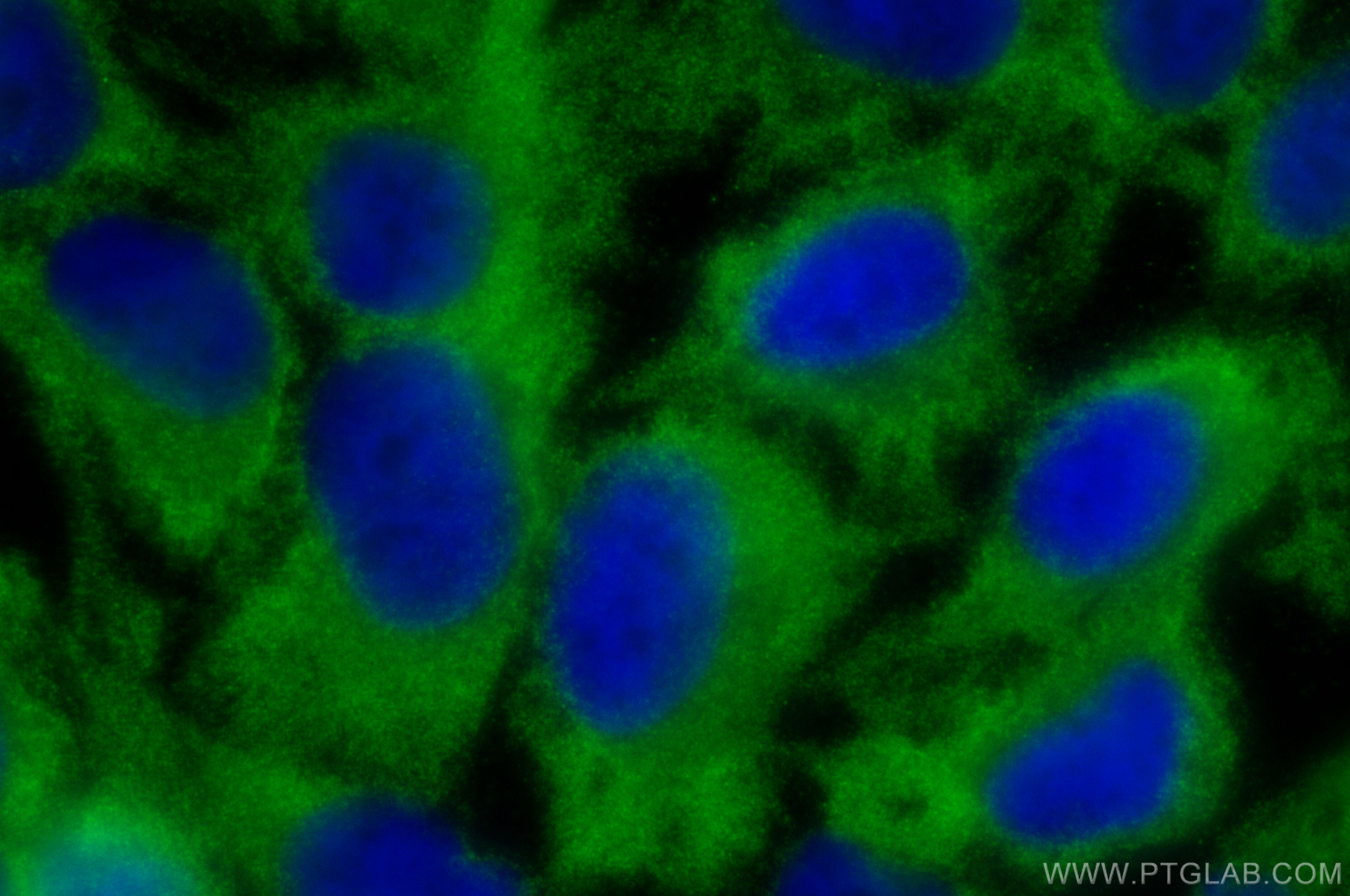 IF Staining of HeLa using 13950-1-AP
