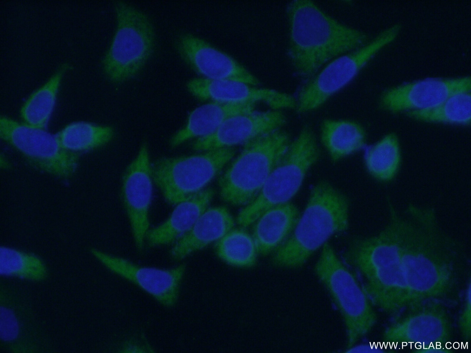 IF Staining of HeLa using 10226-1-AP