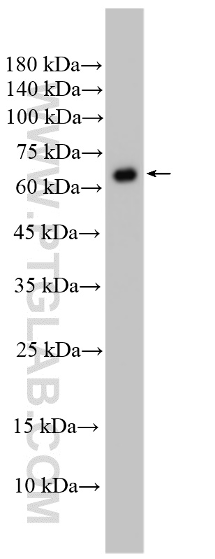 WB analysis of HeLa using 10226-1-AP WB analysis of HeLa using 10226-1-AP