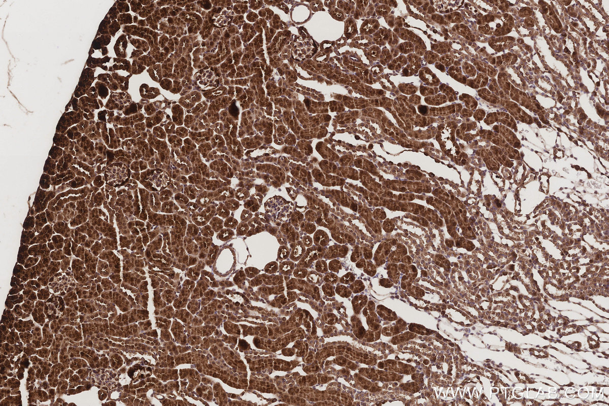 IHC staining of mouse kidney using 13578-1-AP IHC staining of mouse kidney using 13578-1-AP