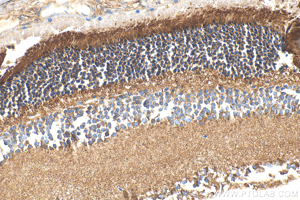 IHC staining of mouse eye using 14269-1-AP
