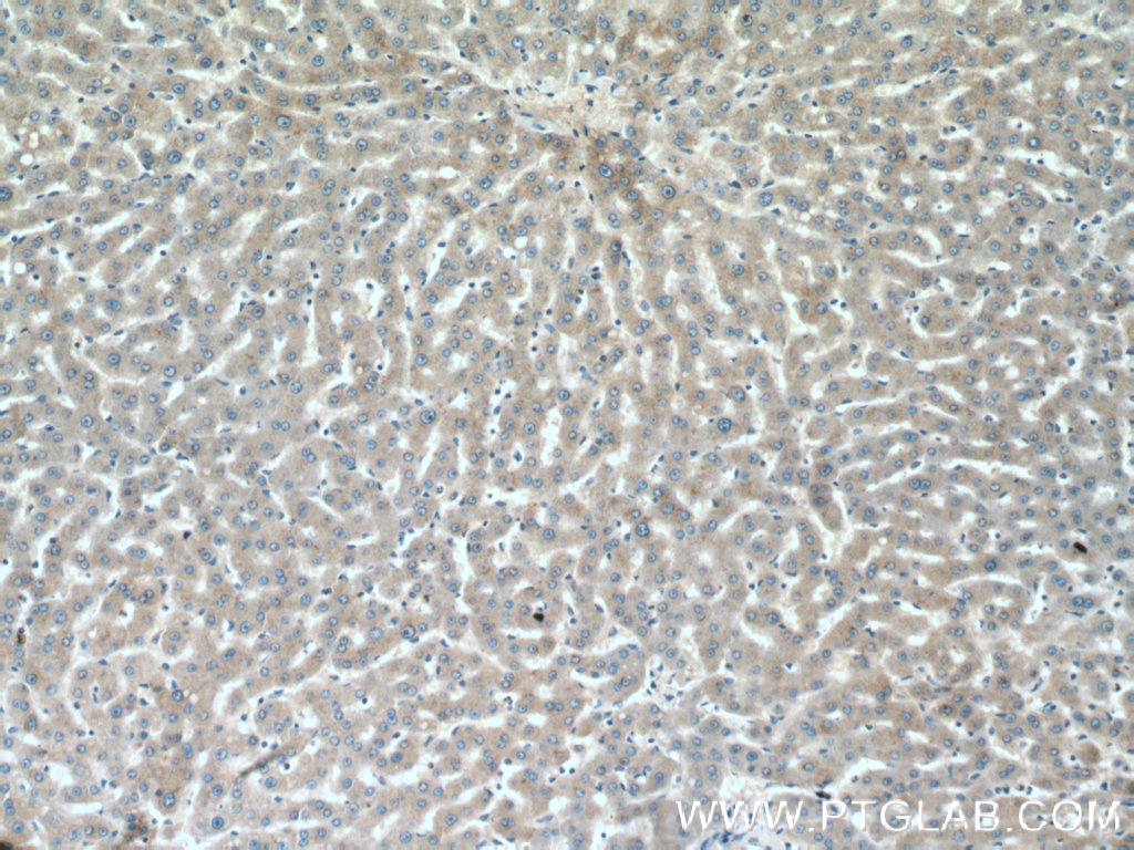 IHC staining of human liver using 27722-1-AP