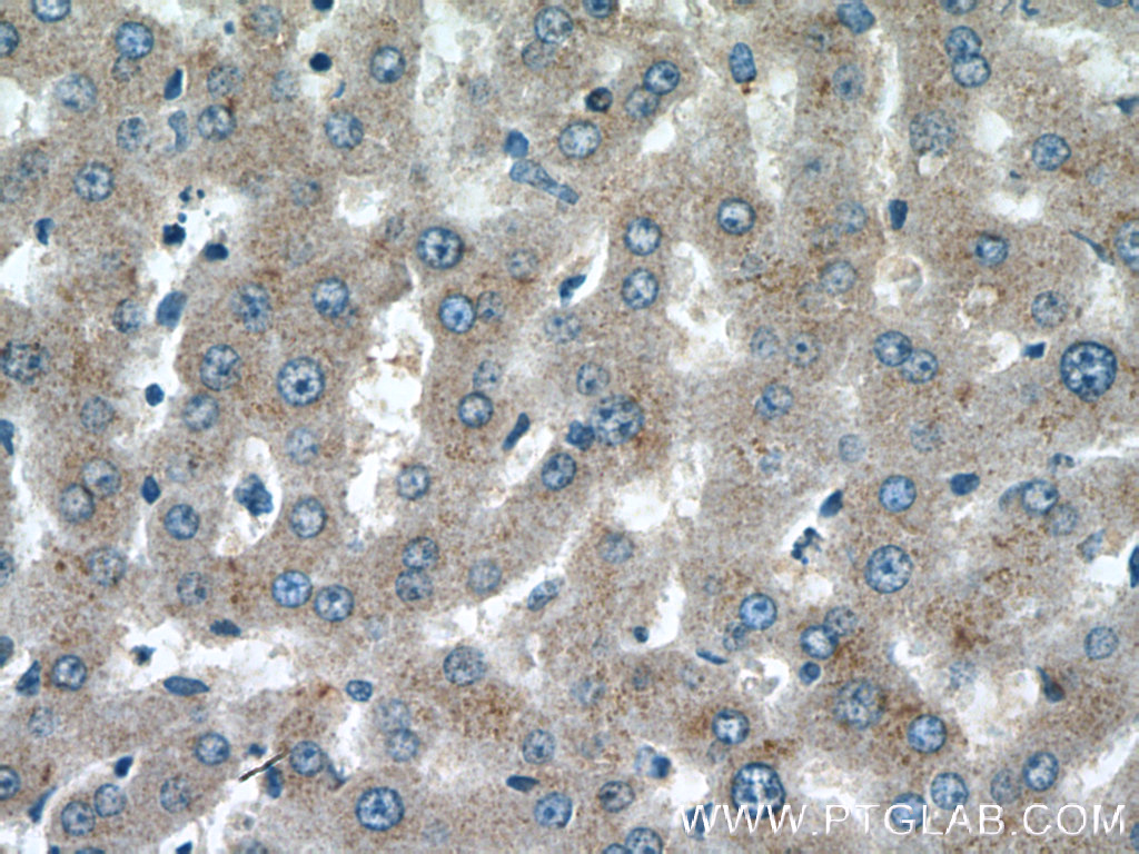 IHC staining of human liver using 27722-1-AP