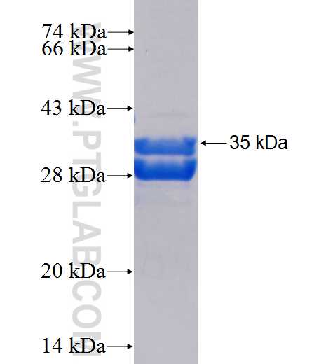 ABCG5 fusion protein Ag26844 SDS-PAGE