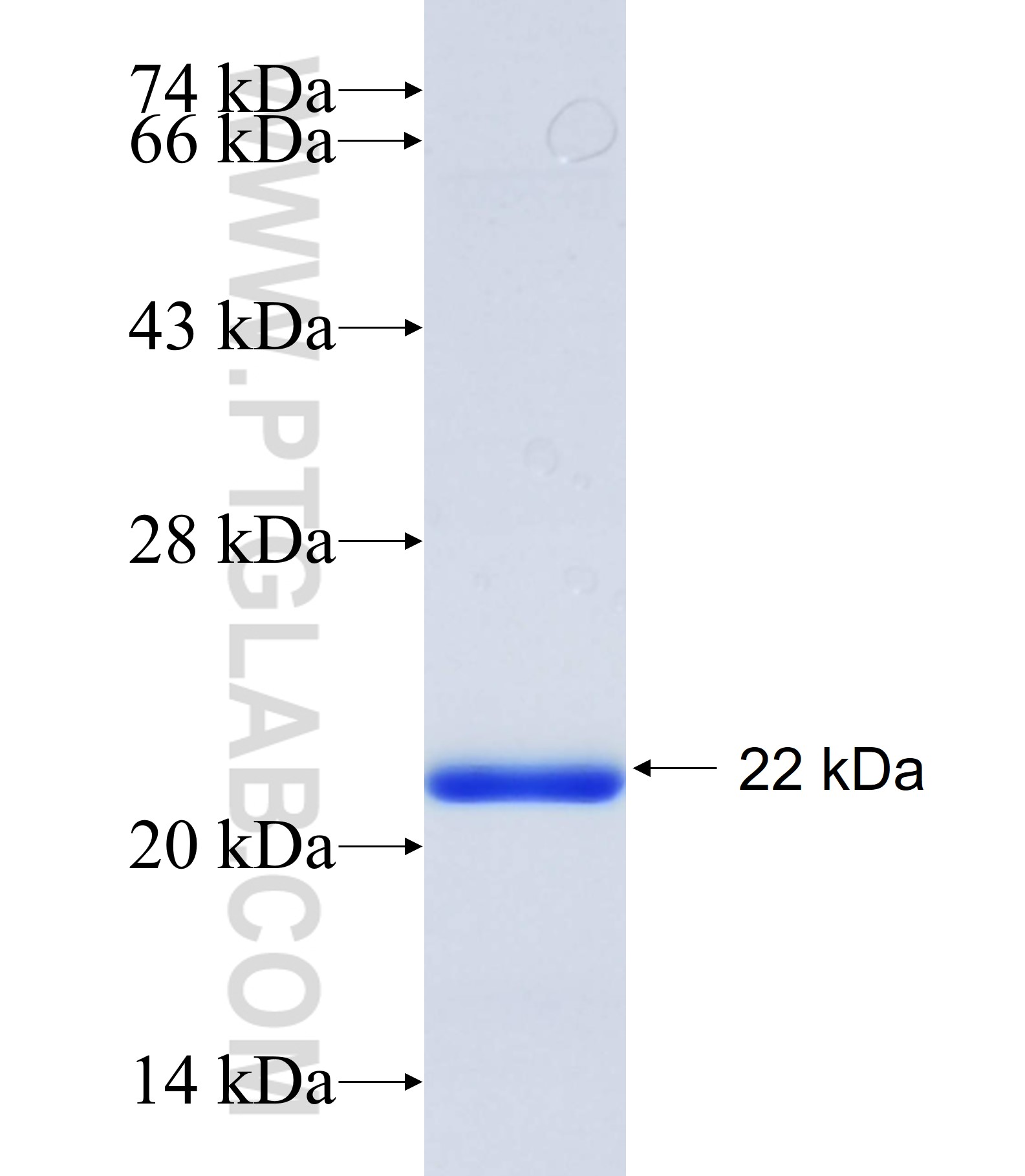 ABCG8 fusion protein Ag34721 SDS-PAGE ABCG8 fusion protein Ag34721 SDS-PAGE