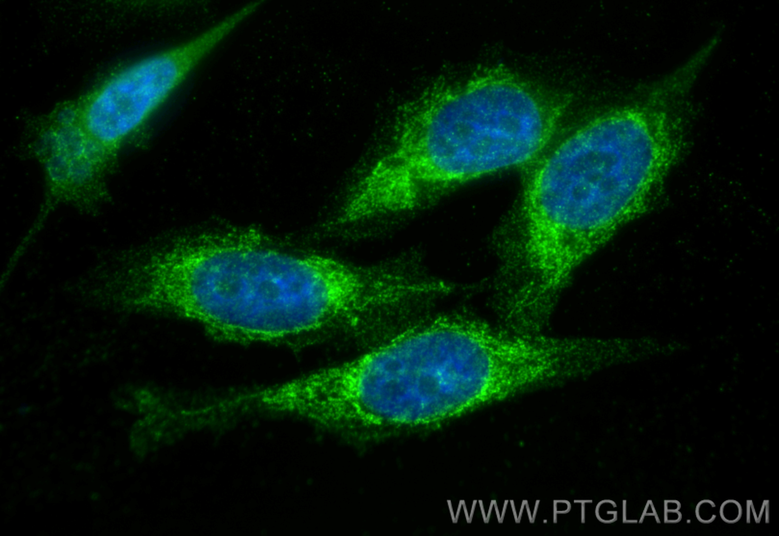 IF Staining of PC-3 using 25355-1-AP