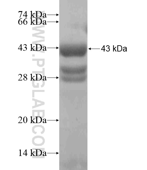 ABHD11 fusion protein Ag19403 SDS-PAGE ABHD11 fusion protein Ag19403 SDS-PAGE