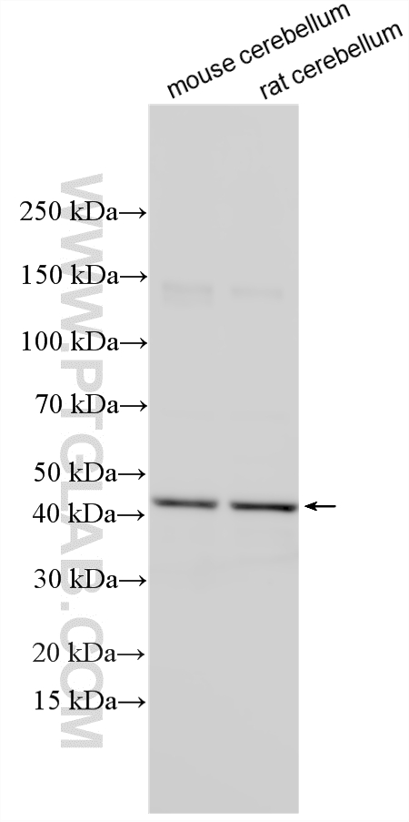 Various lysates were subjected to SDS PAGE followed by western blot with 22660-1-AP (ABHD12 antibody) at dilution of 1:600 incubated at room temperature for 1.5 hours. WB analysis using 22660-1-AP
