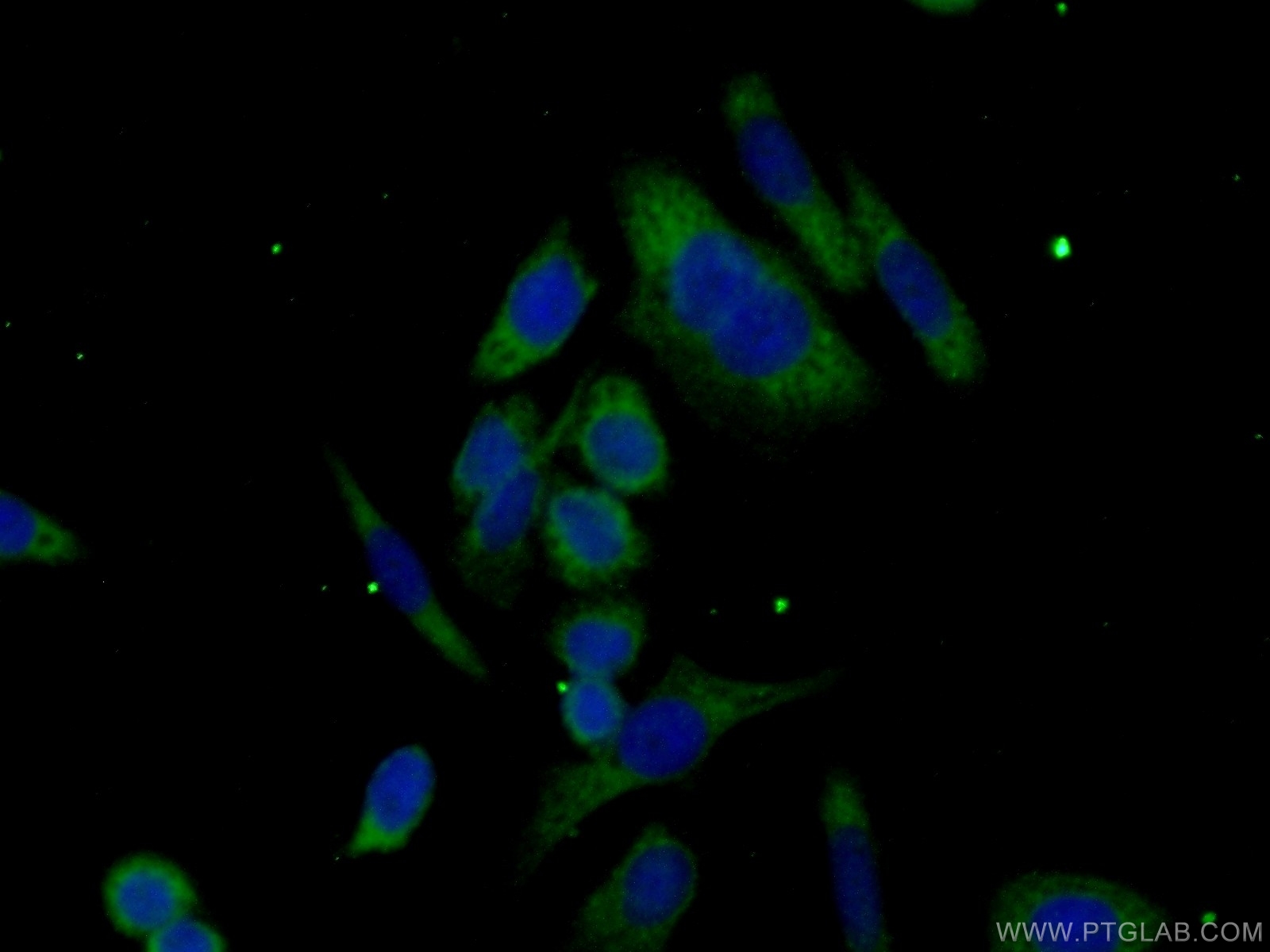 IF Staining of HeLa using 19419-1-AP (same clone as 19419-1-PBS)