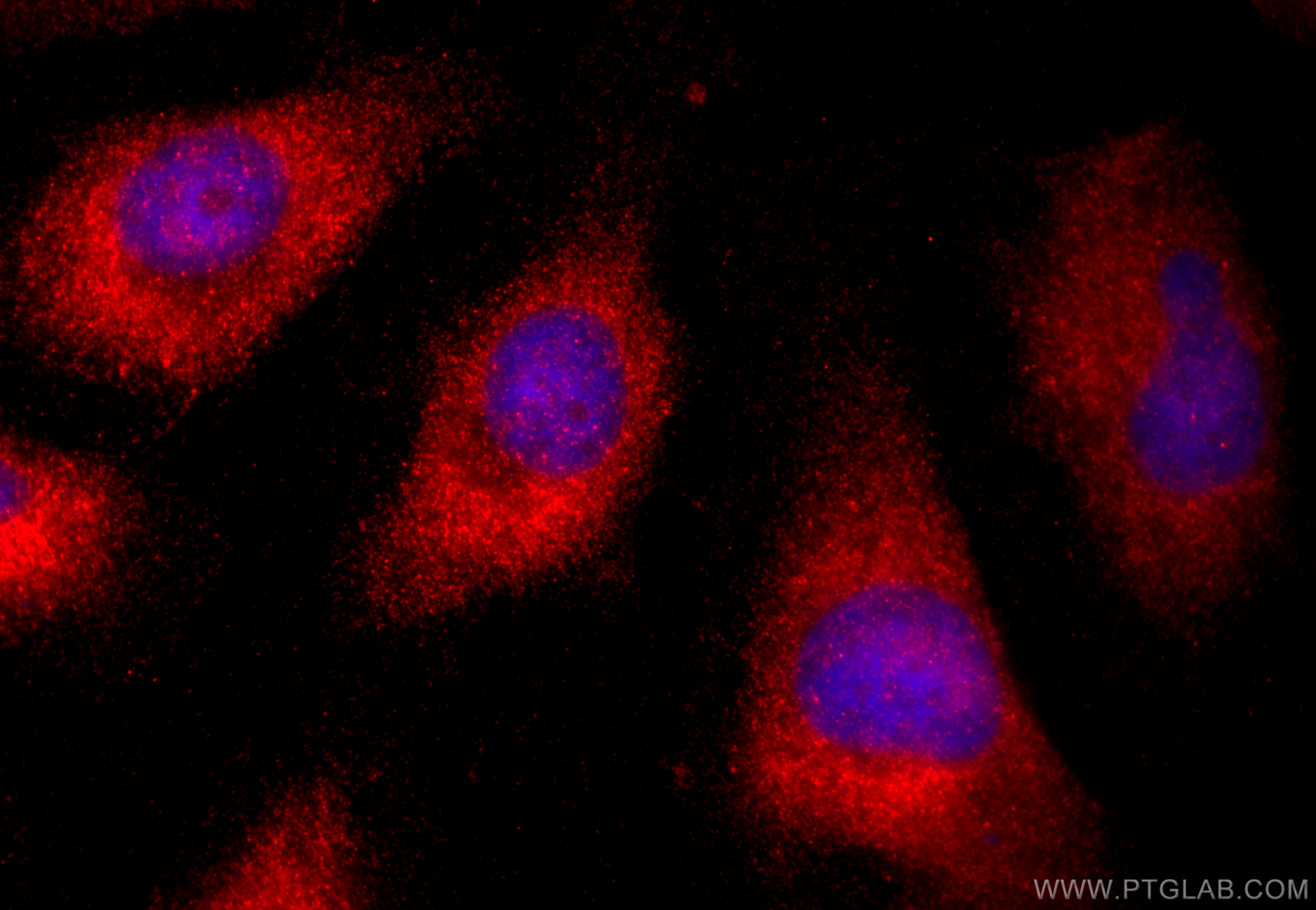 IF Staining of HeLa using 19419-1-AP (same clone as 19419-1-PBS)