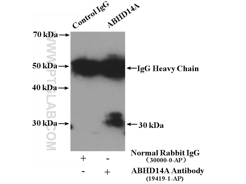 IP experiment of mouse kidney using 19419-1-AP