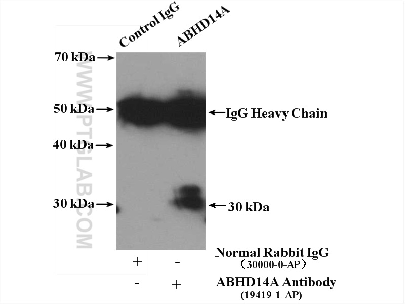 IP experiment of mouse kidney using 19419-1-AP (same clone as 19419-1-PBS)