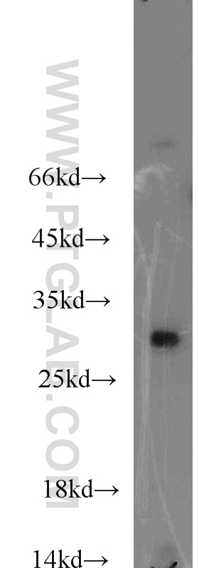WB analysis of mouse kidney using 19419-1-AP (same clone as 19419-1-PBS)
