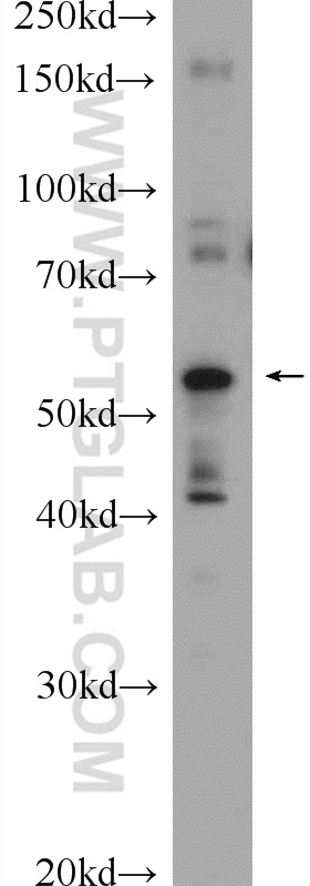 WB analysis of mouse lung using 22526-1-AP