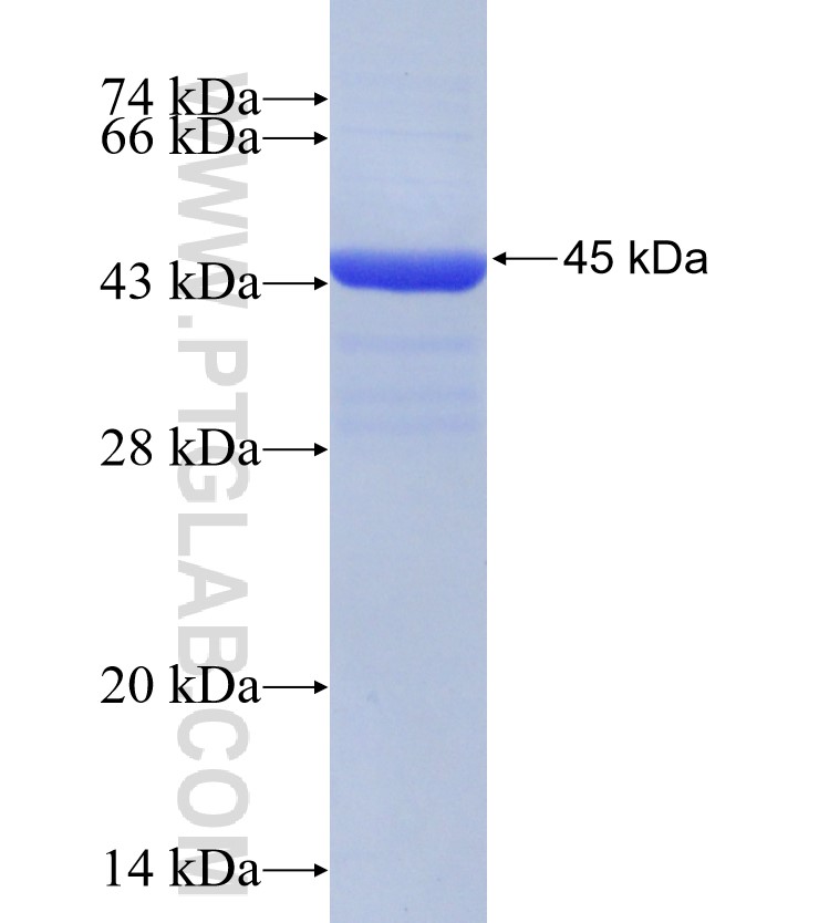 ABHD2 fusion protein Ag31480 SDS-PAGE