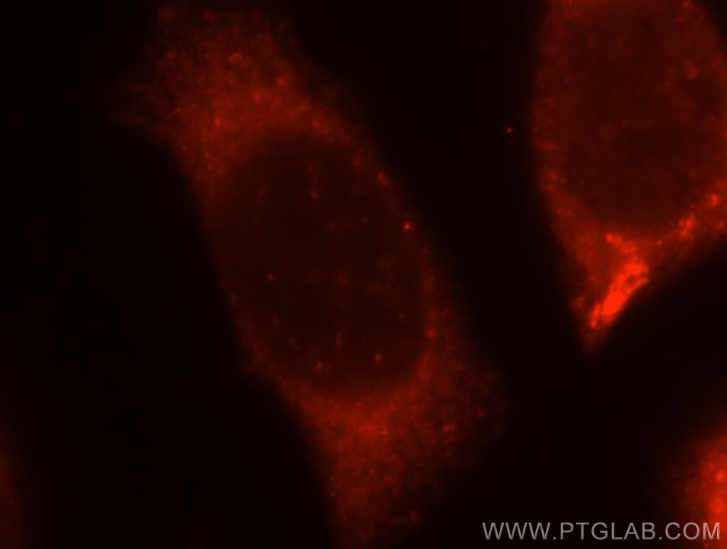 IF Staining of MCF-7 using 12201-1-AP