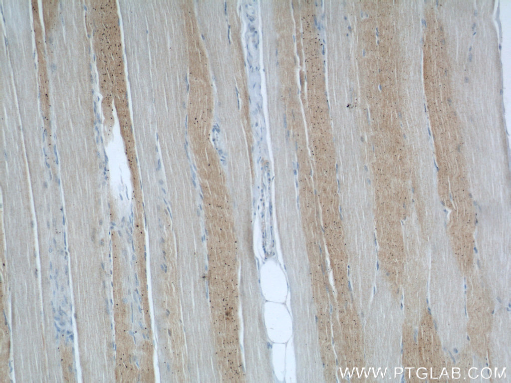 IHC staining of human skeletal muscle using 12201-1-AP